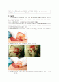 비후성 유문 협착증 케이스 스터디 7페이지