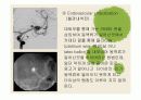 내 머릿속의 시한폭탄 '뇌동맥류' 17페이지