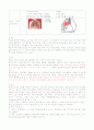 비소세포암(NSCLCa)  사례연구보고서, 케이스스터디 4페이지