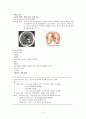 신경외과 실습 case study 간호과정 포함  3페이지
