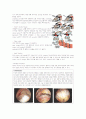 회전근개파열(rotator cuff syndrom) 케이스스터디  5페이지