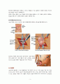 [논문] 충수염(Appendicitis) 3페이지
