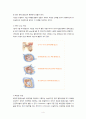 탈 장(Hernia) 4페이지