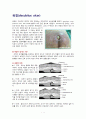 욕창(decubitus ulcer) 1페이지