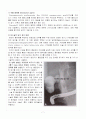 총담관결석 CASE (Common Bile Duct stone) 진단3개 7페이지