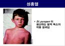 공기매개 병원균, 호흡기 질병 원인균 16페이지