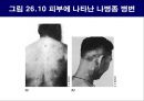 공기매개 병원균, 호흡기 질병 원인균 43페이지