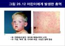 공기매개 병원균, 호흡기 질병 원인균 57페이지