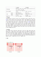 탈장 Hernia(서혜부탈장, 제대탈장) 2페이지