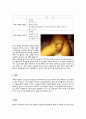 탈장 Hernia(서혜부탈장, 제대탈장) 3페이지
