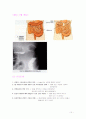 colon ca. case 11페이지