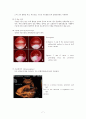 모성간호학-실습 케이스 자궁근종(Uterine myoma) 7페이지