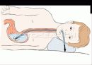 DI (약물중독, Drug intoxication) 12페이지