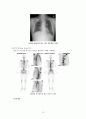 수술실 case study (Laparoscopic Parcial Nephrectomy) 12페이지