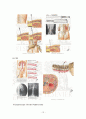 수술실 case study (Laparoscopic Parcial Nephrectomy) 13페이지