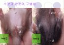 페릿 요점정리 12페이지