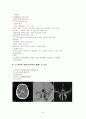 SAH 지주막하 출혈 case study 9페이지