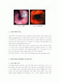 소화성 궤양의 발병 원인과 치료 2페이지