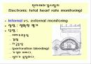 산전태아사정(fetal monitering) 6페이지