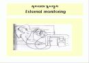 산전태아사정(fetal monitering) 8페이지