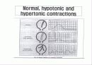 산전태아사정(fetal monitering) 12페이지