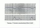 산전태아사정(fetal monitering) 29페이지