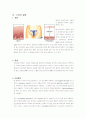 외음부감염, 질염, 자궁경관염, 골반염증성 질환 9페이지