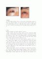 베체트병의 원인 및 증상, 치료방법 7페이지