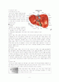 A형간염 case study 3페이지