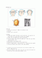 경추 골절의 치료(견인 및 보조기) 3페이지