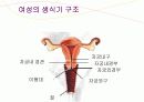 자궁경부암 교육자료 6페이지