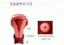 자궁경부암 교육자료 7페이지