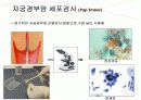 자궁경부암 교육자료 22페이지