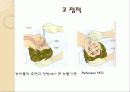 약물 투여법, 약물 투여방법 34페이지