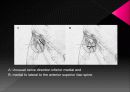 Anatomicl  Variability of the Laterl  Femoral  Cutneous  Nerve : Findings From a Surgical Series 11페이지