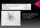 Anatomicl  Variability of the Laterl  Femoral  Cutneous  Nerve : Findings From a Surgical Series 14페이지