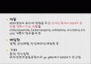 항이뇨호르몬부적절분비증후군 (SIADH) 7페이지