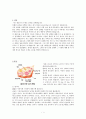 (병리학) 나의 취약한 장기(난소, 다낭성 난소 증후군) 1페이지