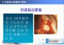 인공 임신중절 (낙태) ppt 4페이지
