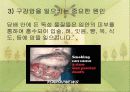 흡연이 구강건강에 미치는 영향 5페이지