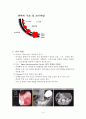 위암 (stomach cancer) 5페이지