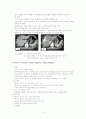 간세포암(HCC, hepatocellular carcinoma) 15페이지