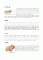 비만과 뇌졸중(cerebrovascular accident) 4페이지