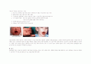 [간호학]Kawasaki disease 3페이지