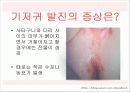 기저귀발진 5페이지
