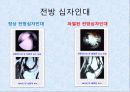 기계체조 선수의 무릎부상과 예방 5페이지