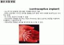 생식 조절(control of Reproduction) 7페이지