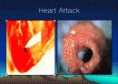 School Health 10페이지