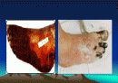 School Health 11페이지