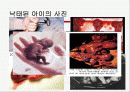 낙태에 대한 고찰과 반대 의견 5페이지